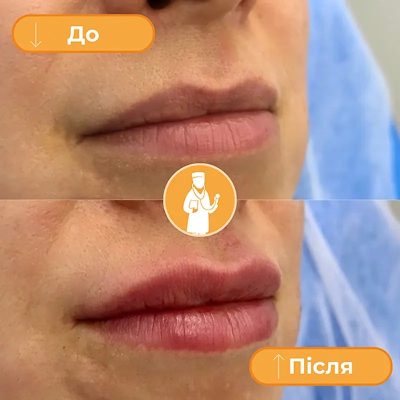 klinika dobrogo doktora-glakin4