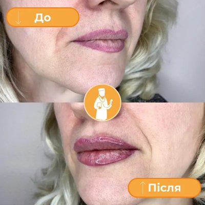 klinika dobrogo doktora-glakin6